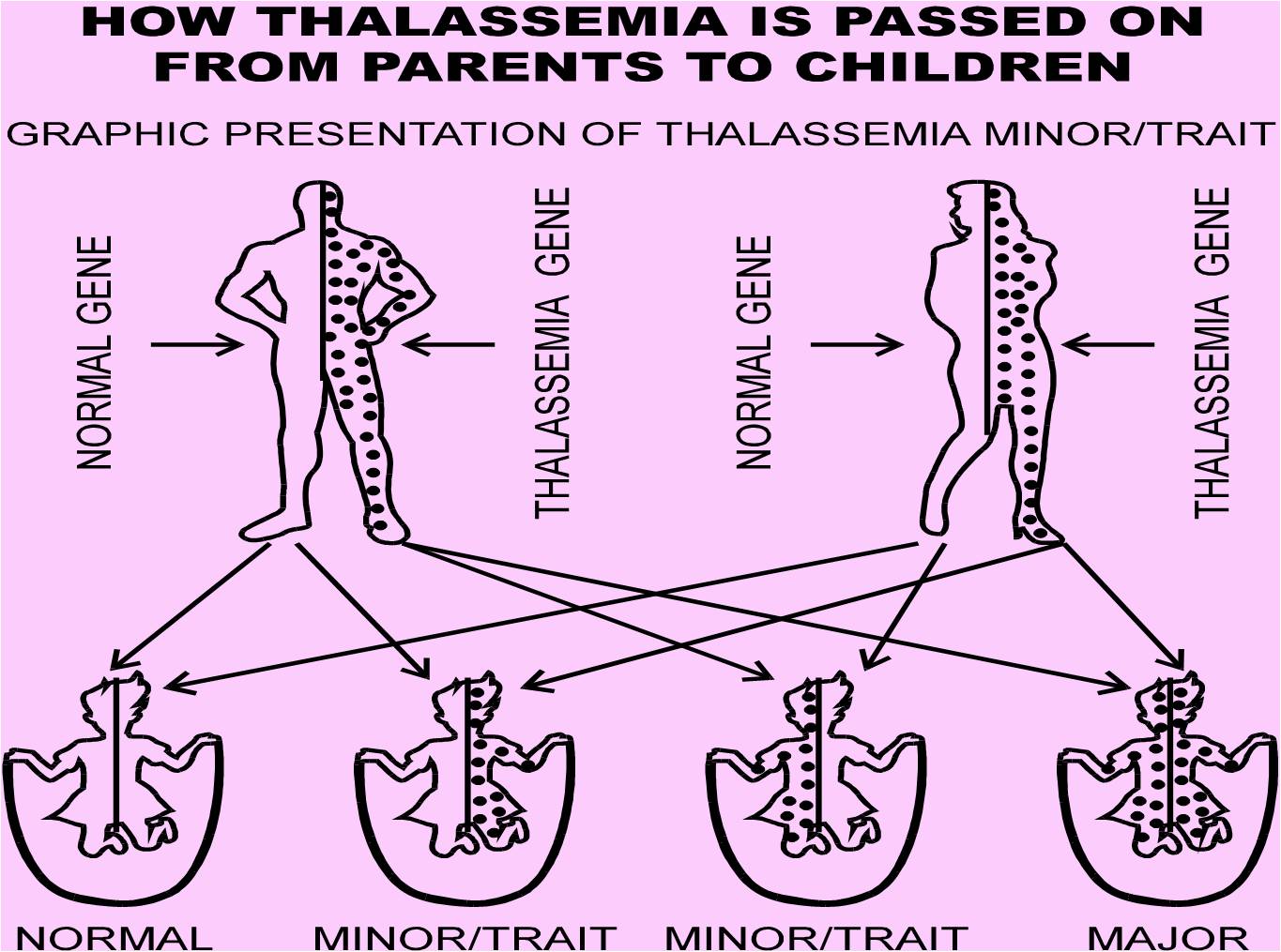 Thalassemia simptom
