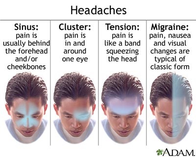 simptom migrain