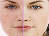tips kulit cantik berseri